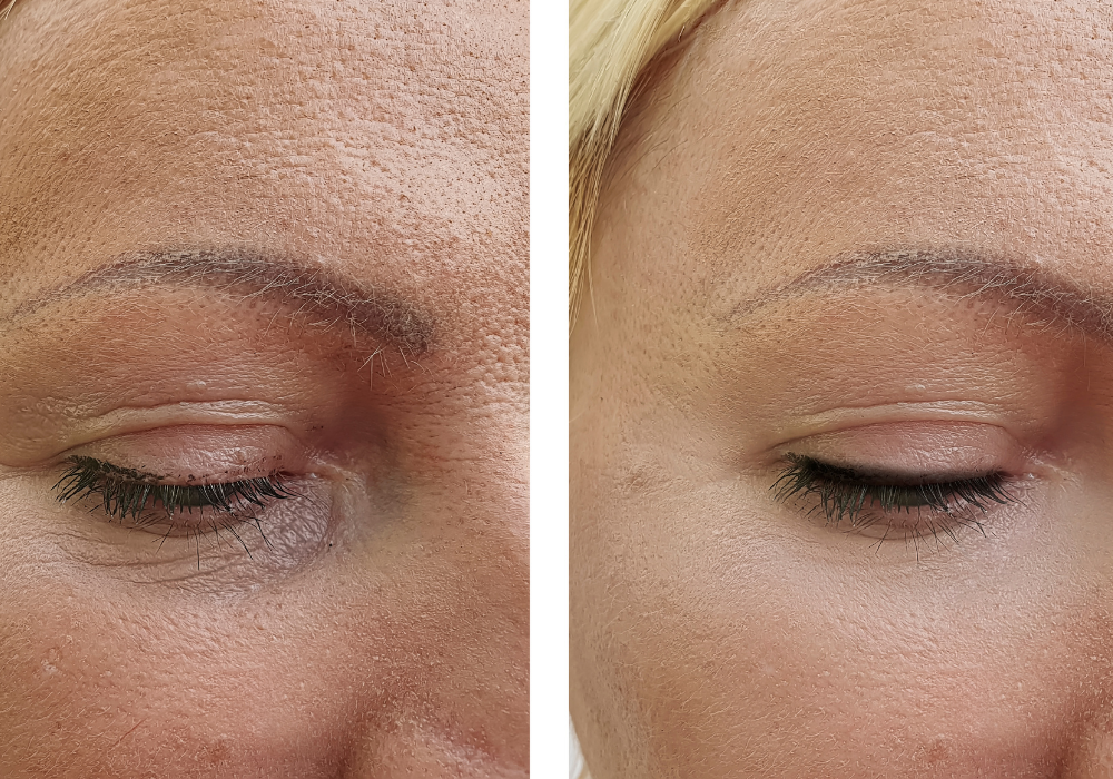 Eye Boosters